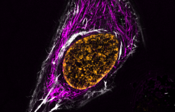 HeLa-cells-with-SPY555-SPY595-SiR-actin-775nm.png